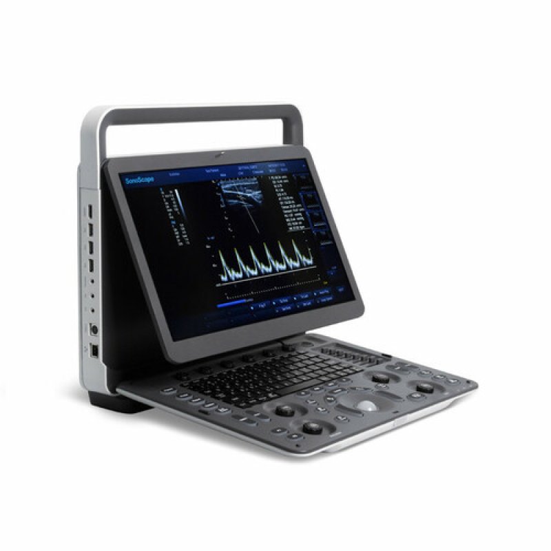 Sonoscope E1 Ultrasound Machine